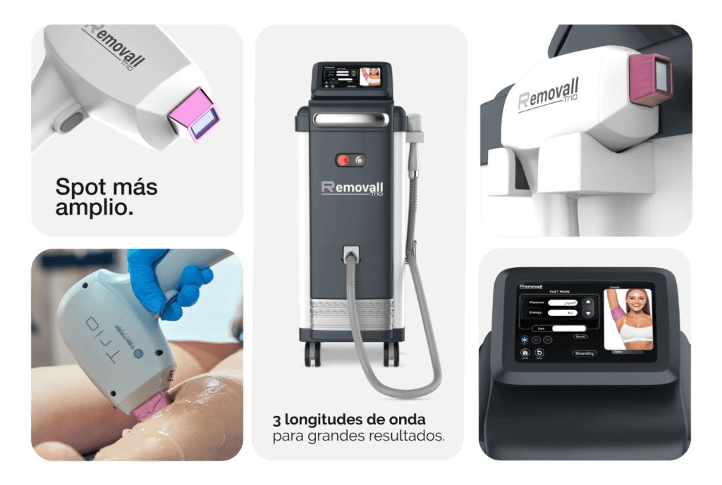 Depilacion laser